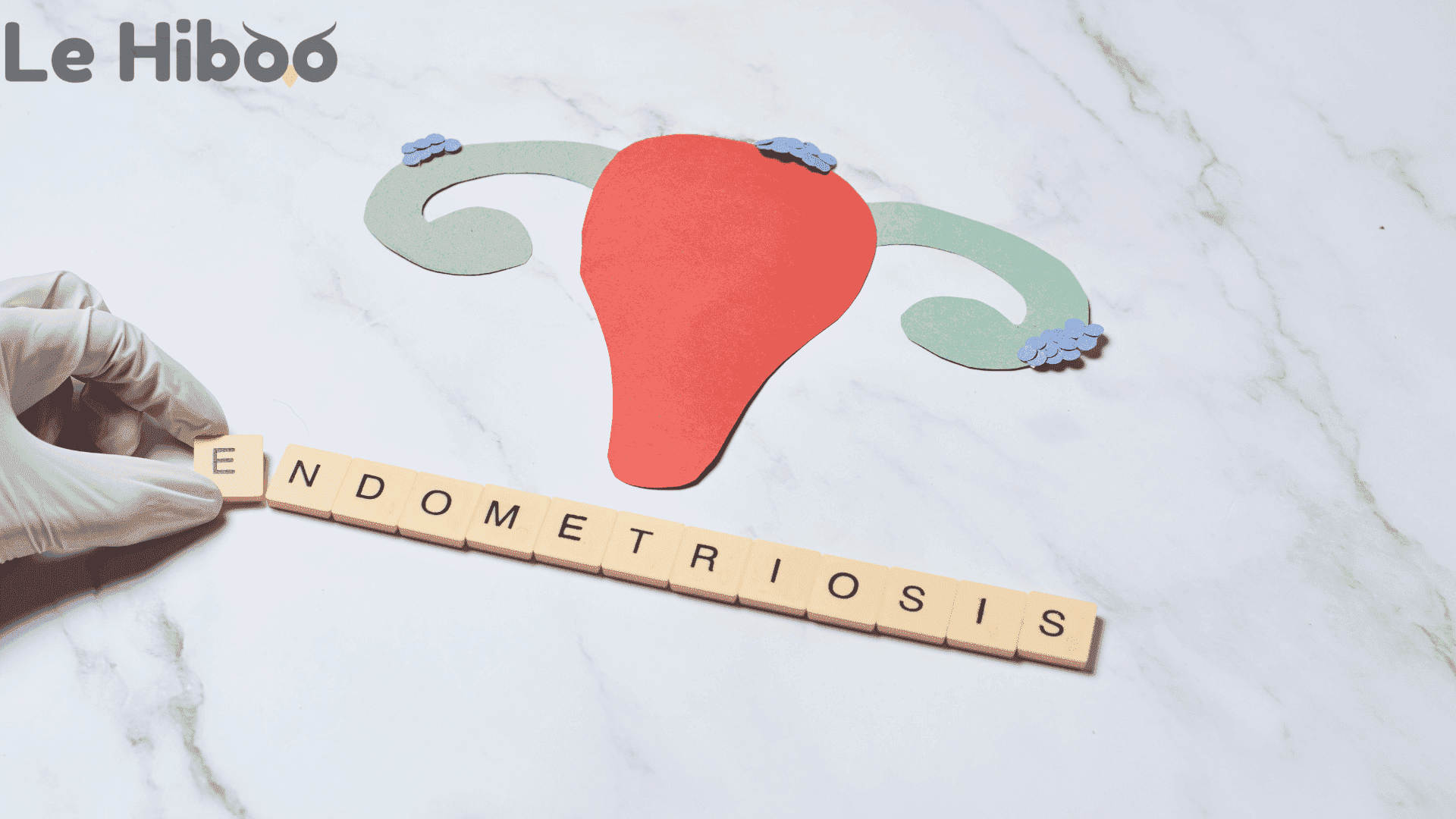 representation de l endometriose 